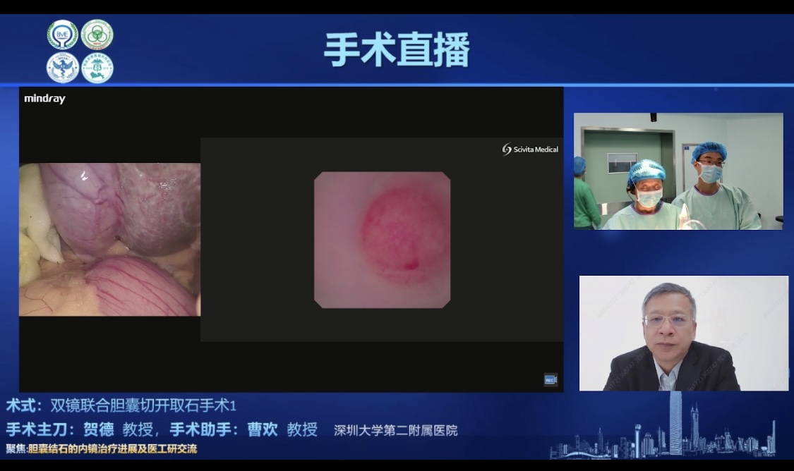 第32次世界内镜医师协会外科联盟学术论坛在深圳举行